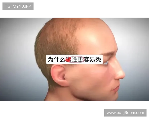 为什么足球运动员很少秃头 解析运动员发量与健康的关系